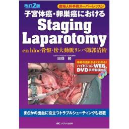 改訂2版　子宮体癌・卵巣癌におけるStaging Laparotomy