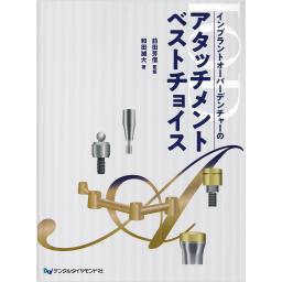 インプラントオーバーデンチャーのアタッチメントベストチョイス
