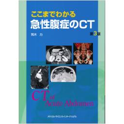 ここまでわかる急性腹症のCT　第3版