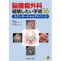 脳腫瘍外科　経験したい手術16