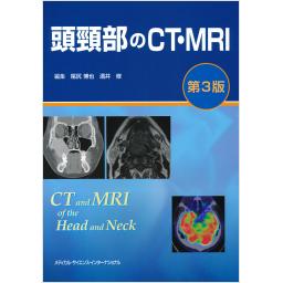 頭頸部のCT・MRI　第3版