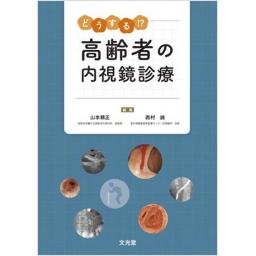 どうする！？　高齢者の内視鏡診療