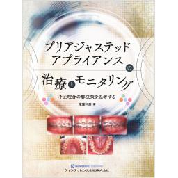 プリアジャステッドアプライアンスの治療とモニタリング