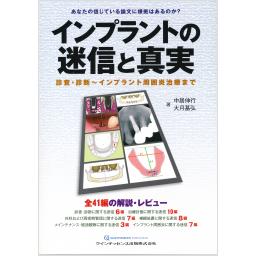 インプラントの迷信と真実