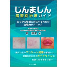じんましん病型別治療ガイド