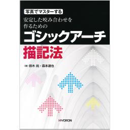 安定した咬み合わせを作るためのゴシックアーチ描記法