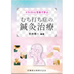 イラストと写真で学ぶ　むち打ち症の鍼灸治療