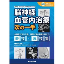 脳神経血管内治療　次の一手
