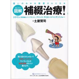 スーパー図解　補綴治療！