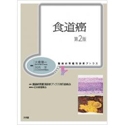 腫瘍病理鑑別診断アトラス 　食道癌　第2版