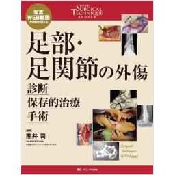 足部・足関節の外傷　診断・保存的治療・手術