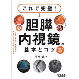 これで完璧！　胆膵内視鏡の基本とコツ