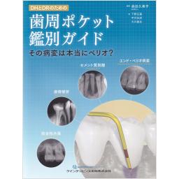 DHとDRのための歯周ポケット鑑別ガイド
