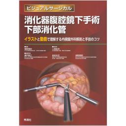 ビジュアルサージカル　消化器腹腔鏡下手術　下部消化管