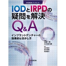 IODとIRPDの疑問を解決Q&A