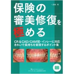 保険の審美修復を極める