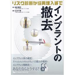 インプラントの撤去　リスク診断から再埋入まで