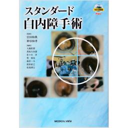 スタンダード白内障手術 ［Web動画付］