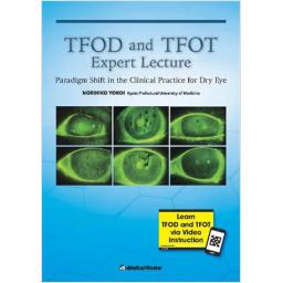 TFOD and TFOT Expert Lecture　Paradigm Shift in the Clinical Practice for Dry Eye