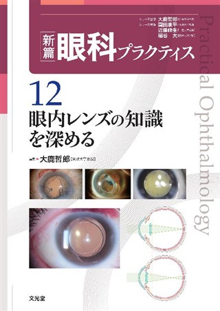眼内レンズの知識を深める (新篇眼科プラクティス 12) 商品詳細ページ | メディカルブックセンター