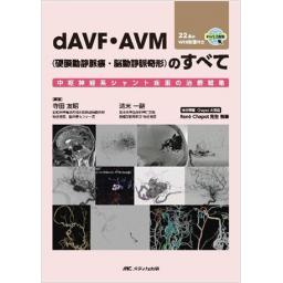 dAVF・AVM（硬膜動静脈瘻・脳動静脈奇形）のすべて