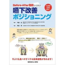 Before-After動画から学ぶ　嚥下改善ポジショニング