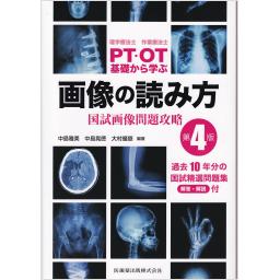 理学療法士・作業療法士　PT・OT　基礎から学ぶ　画像の読み方　第4版　国試画像問題攻略
