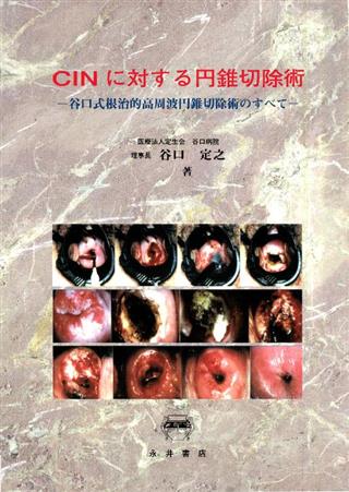 後 術 円錐 切除 円錐切除手術のリスク・合併症と対処法について