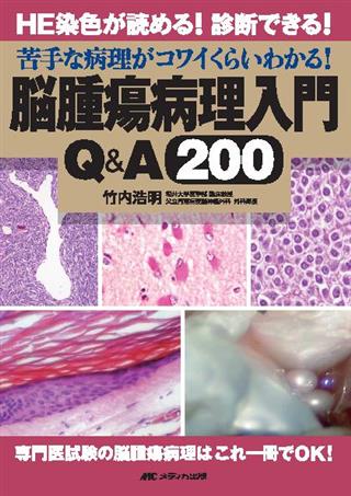 脳腫瘍病理入門Q&A200 HE染色が読める!診断できる!苦手な病理が