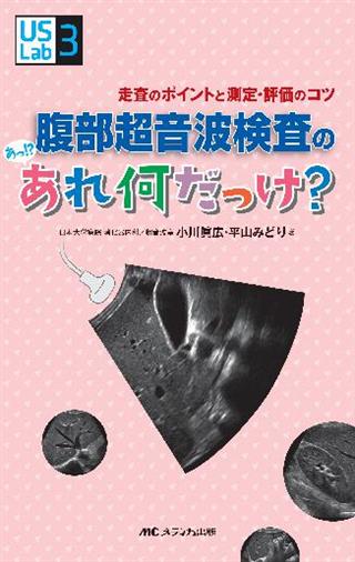 3DCTで解剖から学ぶ腹部エコーの基本とコツ〜血管を指標にした