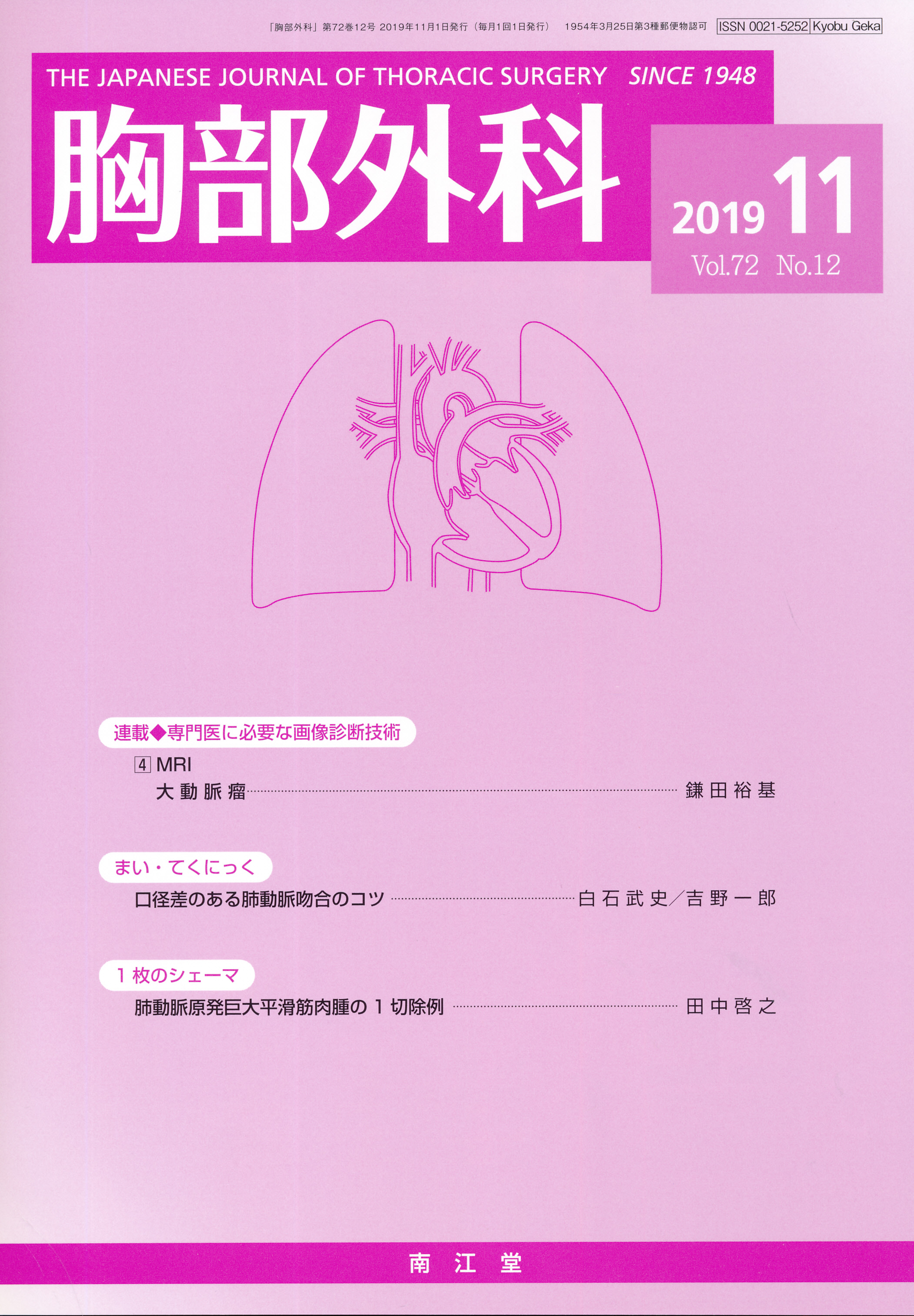気胸 右 自然