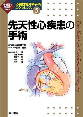 大動脈疾患の手術 第4巻