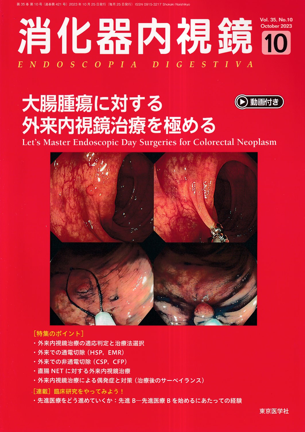 消化器内視鏡36巻4号2024年4月増大号 十二指腸・小腸アトラス